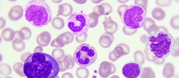 white-blood-cells.jpg