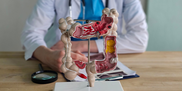 Medical model shows human colon structure